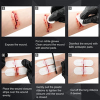 Load image into Gallery viewer, Comprehensive Medical Kit For Wound Dresssing